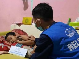 Tolong! Bocah di Surabaya Menderita Tumor Mata Stadium Akhir Butuh Bantuan