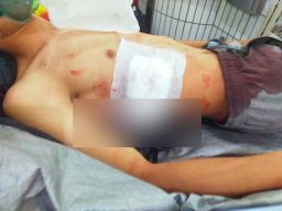 Pemuda di Surabaya Jadi Korban Pembacokan