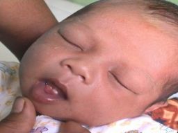 Fenomena Bayi Baru Lahir Sudah Tumbuh Gigi, Ini Kata Pakar