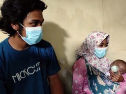 Tolong! Bayi Penderita Hidrosefalus di Jombang Butuh Bantuan