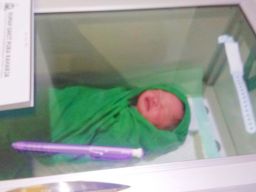 Peneliti Unair Ciptakan Fototerapi untuk Terapi Bayi Kuning