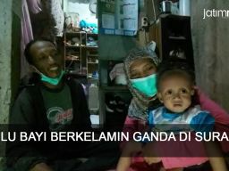 Video: Pilu Bayi Berkelamin Ganda di Surabaya