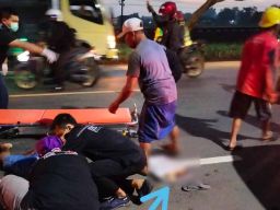 Tabrak Truk Misterius di Pasuruan, Kaki Pemotor asal Grati Putus