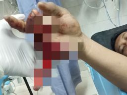 2 Pemuda Lamongan Dibacok Orang Tak Dikenal, Begini Kronologinya