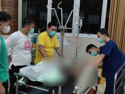 Remaja Tersambar Api saat Kecelakaan Motor di Bojonegoro Meninggal Dunia