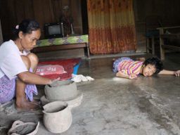 Tolong! Anak 11 Tahun Penderita Gangguan Syaraf Otak di Jombang Butuh Bantuan