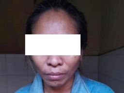 Curi Perhiasan Rp18 Juta saat Pijat Pelanggan, Eks PSK Dolly Diamankan Polisi