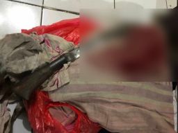 Digorok Anaknya Saat Tidur, Ibu di Jember Jalani Operasi