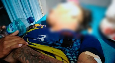 Warga Kabuh Jombang Korban Kebrutalan Oknum Pesilat Dirawat di RSUD Ngimbang