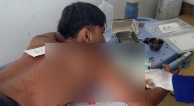 Siswa SMK di Mojokerto Dibacok Orang Misterius