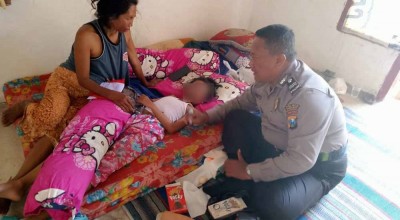 Nyalakan Lampu Spirtus, Wajah Siswi Terbakar saat Perkemahan di Sumenep