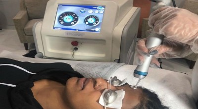 Menengok Kecanggihan Laser PicoWay untuk Perawatan Kecantikan