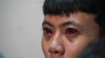 Temuan TGIPF: Korban Tragedi Kanjuruhan Alami Pendarahan Mata hingga Trauma