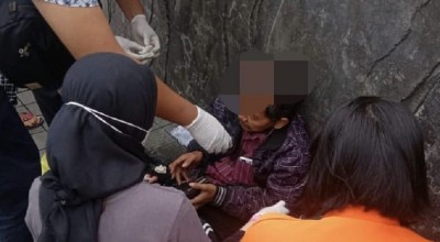 Pemotor Tabrak Mobil hingga Kepalanya Sobek, Gegara Melamun?