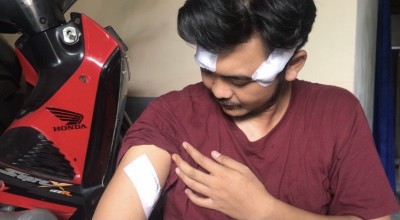 2 Pegawai SPBU Sidoarjo Dibacok, Dituduh Goda Istri Orang