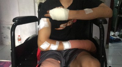 Belasan Gangster Bersajam Keroyok Pemuda asal Sidoarjo