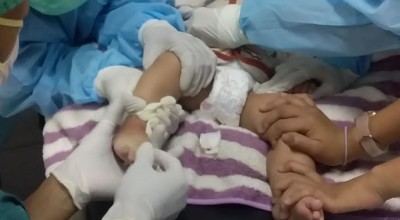 Pilu Keluarga Bayi Hidrosefalus di Lamongan: Tekanan Mental, Kesulitan Ekonomi