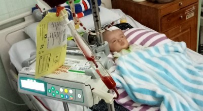 Bayi Pengidap Hidrosefalus asal Lamongan, Tubuhnya Dipenuhi Jahitan dan Selang