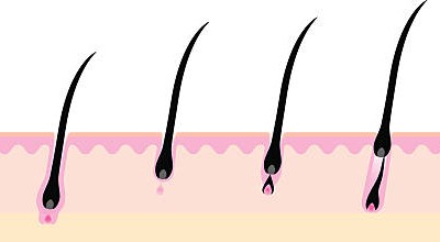 Jangan Sampai Salah Sis, Lima Cara Rapikan Bulu Kemaluan