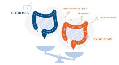 Ingat! Manusia Bisa Sehat dan Sakit Berawal dari Kondisi Usus