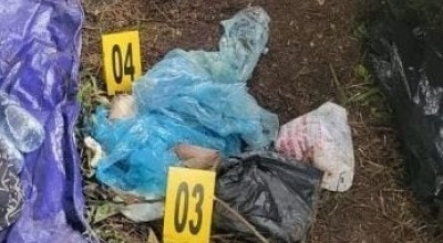 Tim Medis Ambil Sampel untuk Pastikan Penyebab Keracunan Ratusan Mahasiswa UB