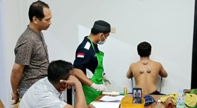 Dobel Detoks, Warga Banyuwangi Pilih Bekam Saat Puasa Ramadan