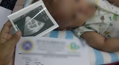 Kondisi Terkini Bayi Hidrosefalus di Lamongan Usai 6 Kali Operasi