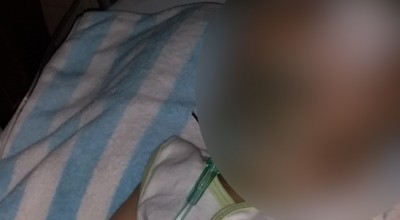 Bayi Hidrosefalus asal Lamongan, Konsumsi Obat Kejang Seumur Hidup