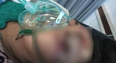 Begal Nyaru Sales Minyak di Sidoarjo Hajar Emak-emak, Rampas Rp1,5 Juta