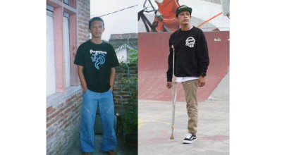 Pria Asal Malang Tetap Semangat Breakdance Walau Hanya Berkaki 1, Luar Biasa..