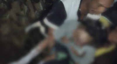 Petasan Meledak saat Diracik, 2 Warga Probolinggo Alami Luka Bakar