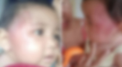 Kesal karena Terus Menangis, Ayah Aniaya Bayi 8 Bulan di Probolinggo