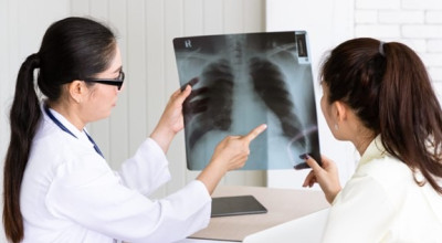 Waspada TBC: Kenali, Cegah dan Obati Sampai Sembuh!