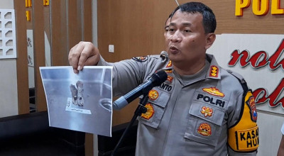 Ungkap Kerangka Manusia di Surabaya, Polda Jatim Buka Aduan Orang Hilang