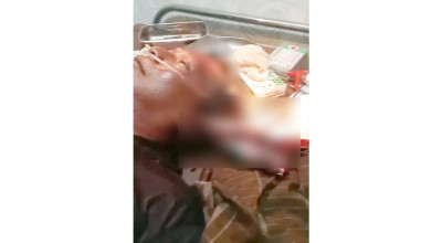 Warga Pamekasan Dilarikan ke RS gegara Tertusuk Moncong Ikan Marlin