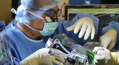 Operasi Sendi Lutut Canggih di Mayapada Hospital Surabaya