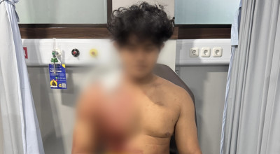 Vokalis Band Hardcore di Malang Dikeroyok dan Dibacok, 8 Orang Diamankan Polisi