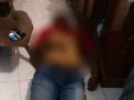 Asma Kambuh, Pria Ini Tewas Usai Nonton Bazar Blitar Jadoel