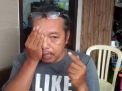 Mata Pria di Surabaya Jadi Rabun, Istri Sebut akibat Kena Disinfektan