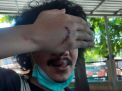 Polisi Buru Pelaku Pengeroyokan Editor detikcom