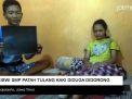 Video: Siswi SMP Patah Tulang Kaki Diduga Didorong Temannya
