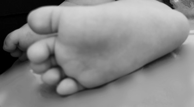 Balita di Gresik Tertimpa Alat Olahraga, Meninggal karena Pembuluh Darah Pecah