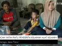 Video: Bocah Yatim Piatu Penderita Kelainan Alat Kelamin