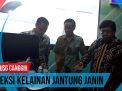 Video: Mesin USG Canggih, Deteksi Kelainan Jantung Janin