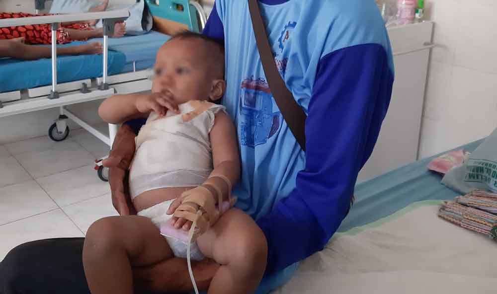 Maftuh Ahnan, balita di Ponorogo yang tersiram air panas