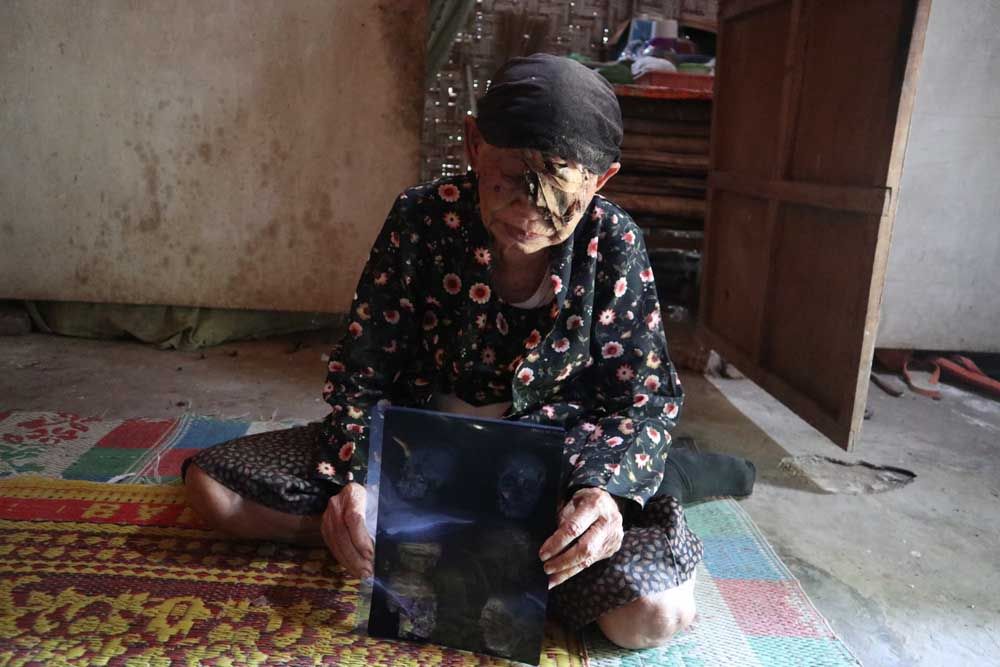 Nenek Sarjinah tunjukkan rontgen dari dokter