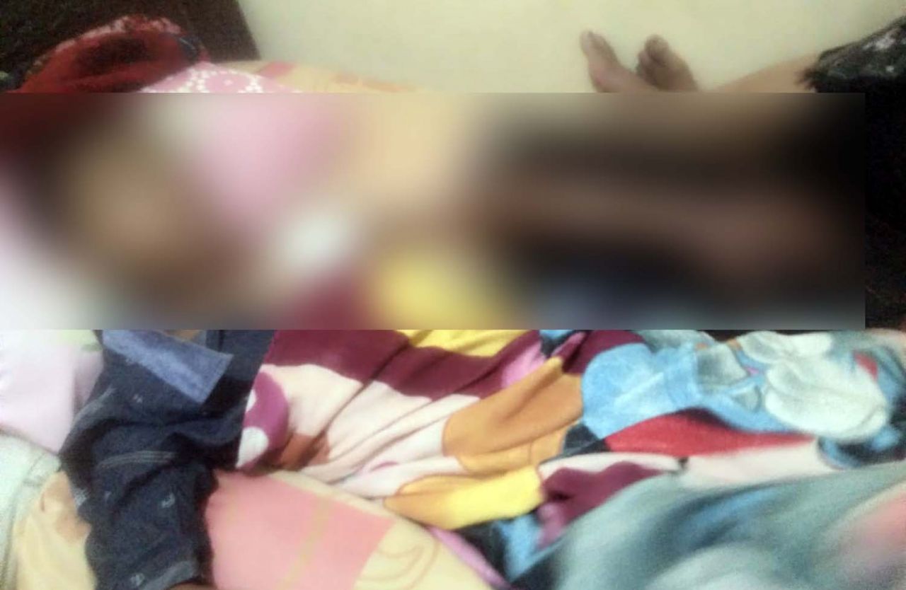 Bocah 12 tahun di Mojokerto yang tersambar petir