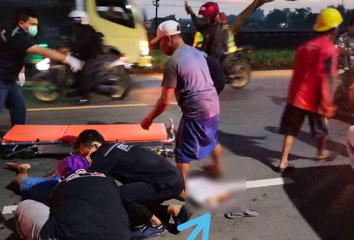 Korban kakinya putus usai tabrakan dengan truk. (Foto: Polres Pasuruan for jatimnow.com)