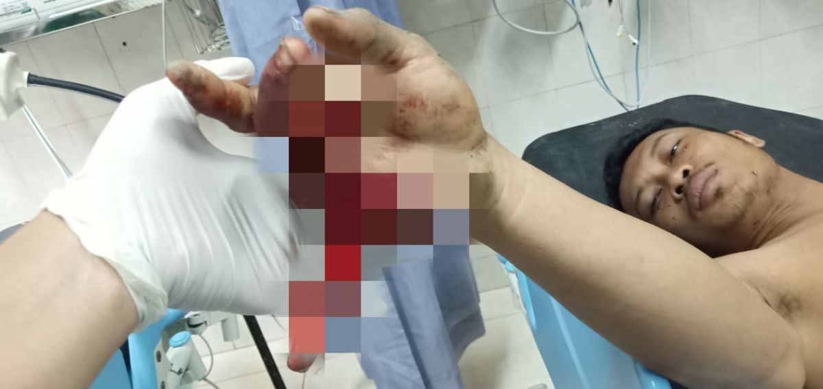 2 Pemuda Lamongan Dibacok Orang Tak Dikenal, Begini Kronologinya