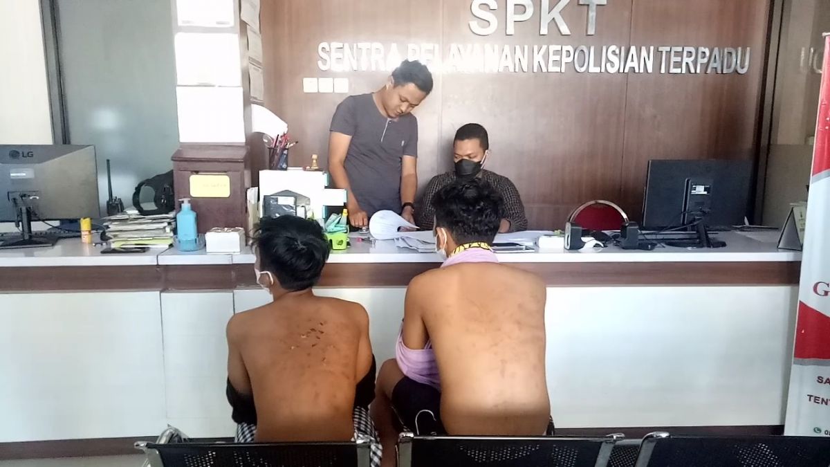 Kedua korban berada di SPKT Polres Pasuruan memenunjukkan luka akibat dianaya seniornya di asrama sekolah. (Foto: Moch. Rois/jatimnow.com)